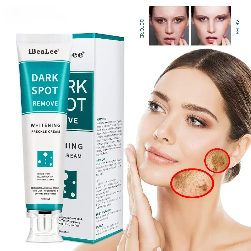 Whitening Freckle Cream Remove - Skincare Glowing ulasan dan harga