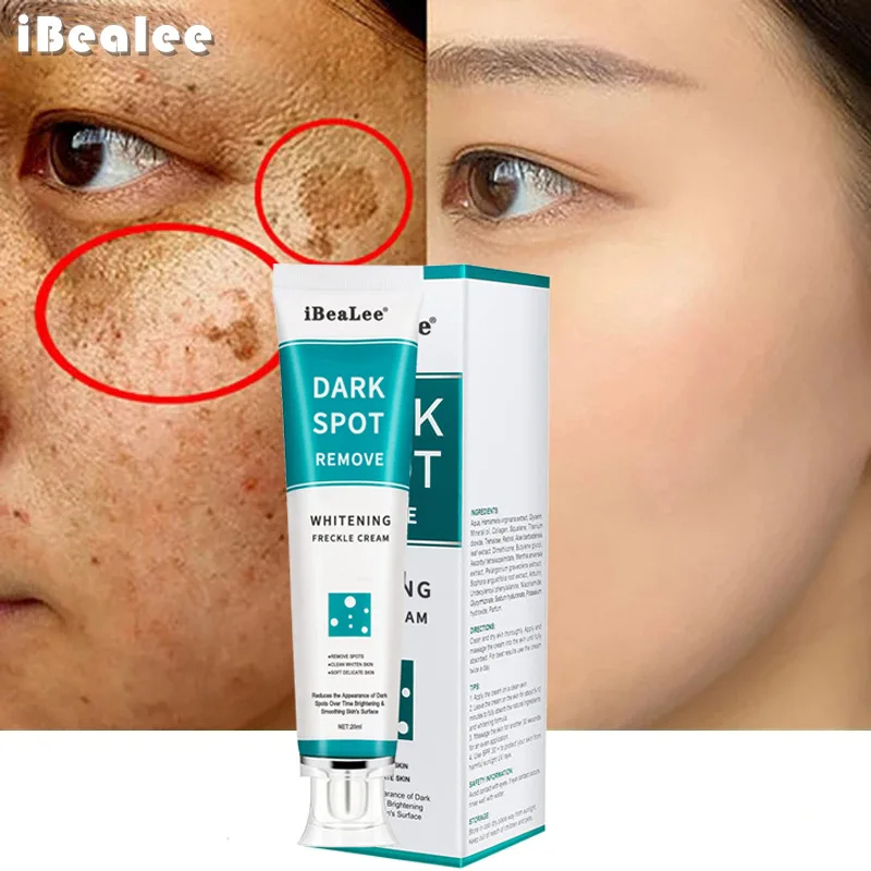 Whitening Freckle Cream Remove - Skincare Glowing ulasan dan harga