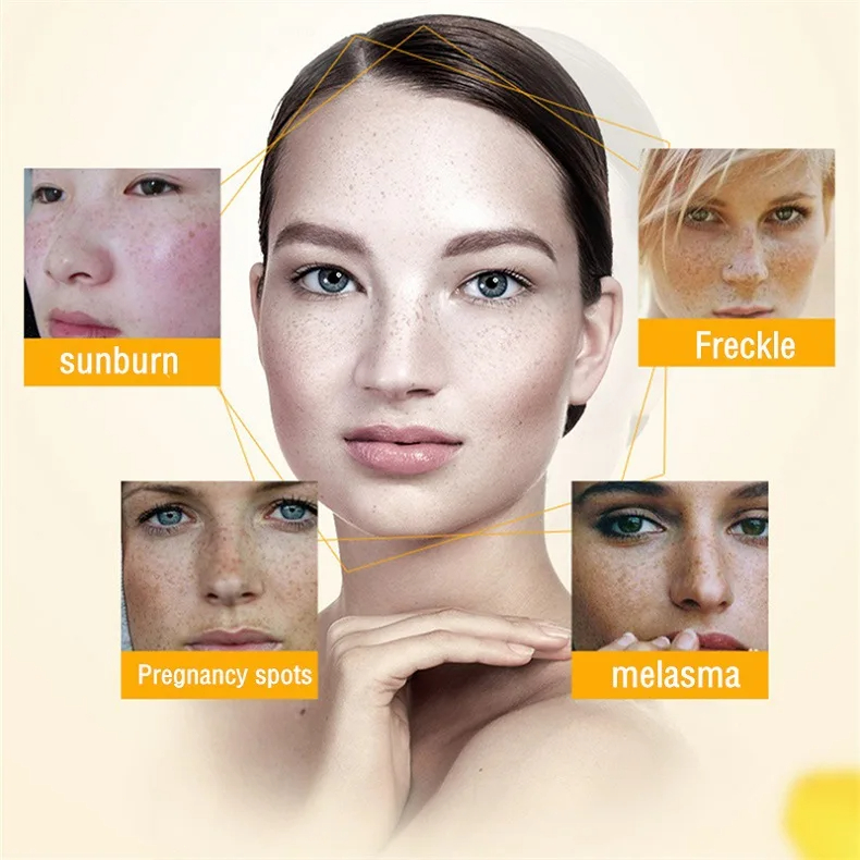 Whitening Freckle Cream Remove - Skincare Glowing ulasan dan harga